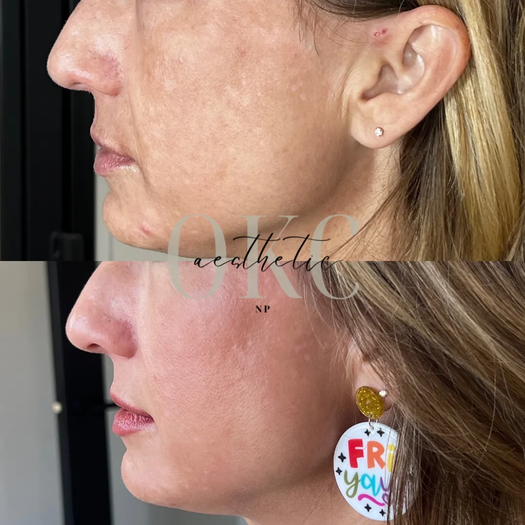 | MEDICAL SKINCARE Before and After Images | Lou Lou Med Spa