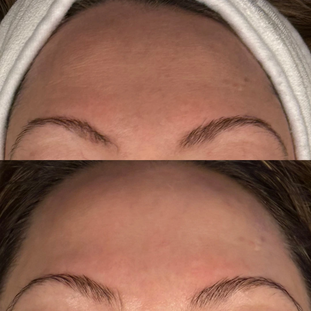 before and after