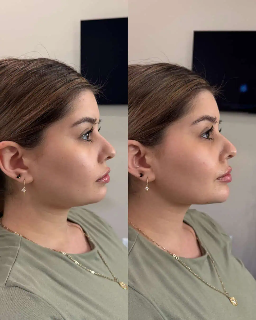 Facial Harmony Trio21
