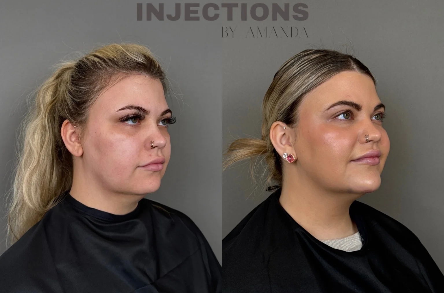 Better Than Ever Package Before and After - 19 better-than-ever-package-before-and-after-1