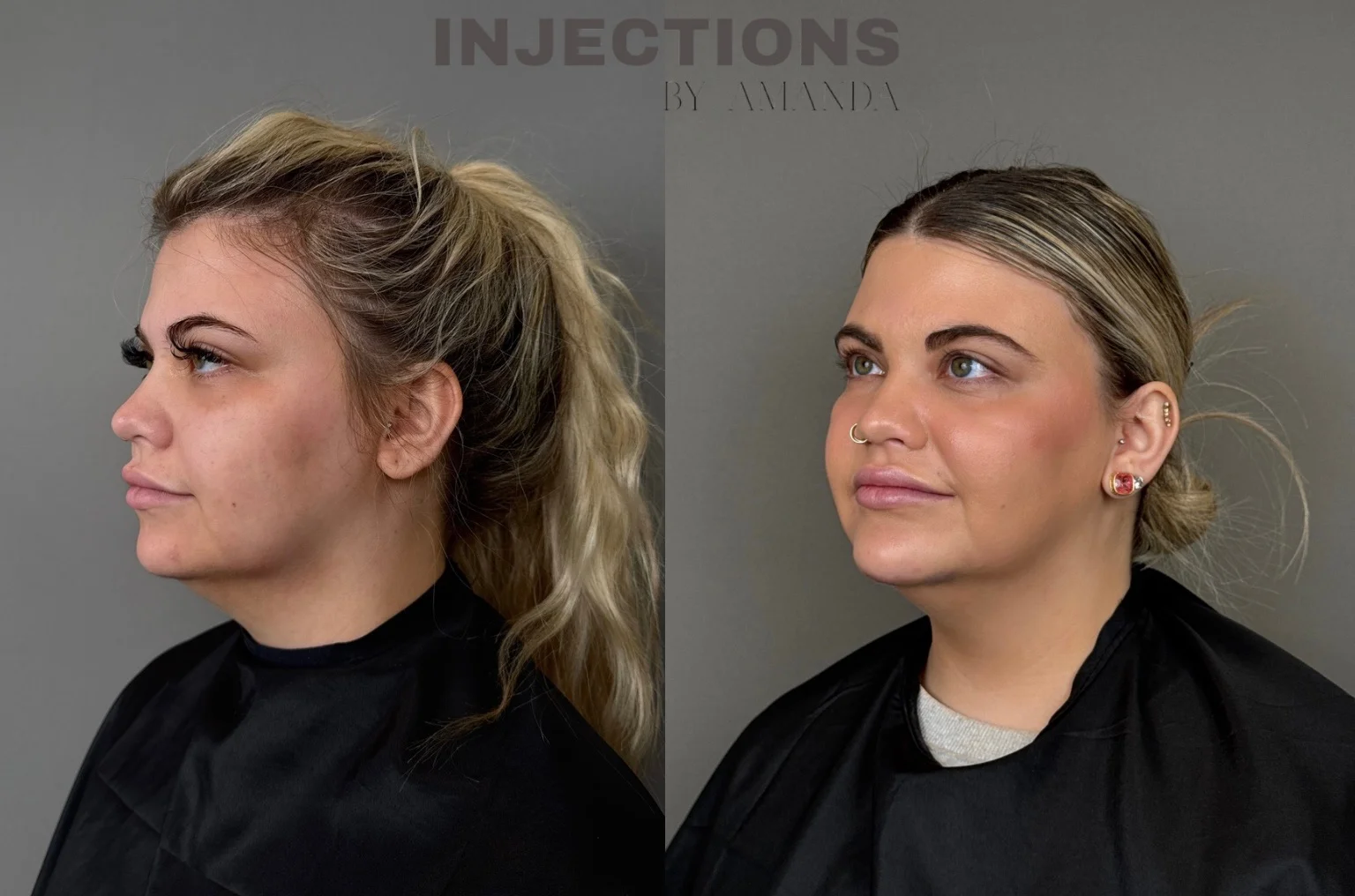 Better Than Ever Package Before and After - 20 better-than-ever-package-before-and-after-2