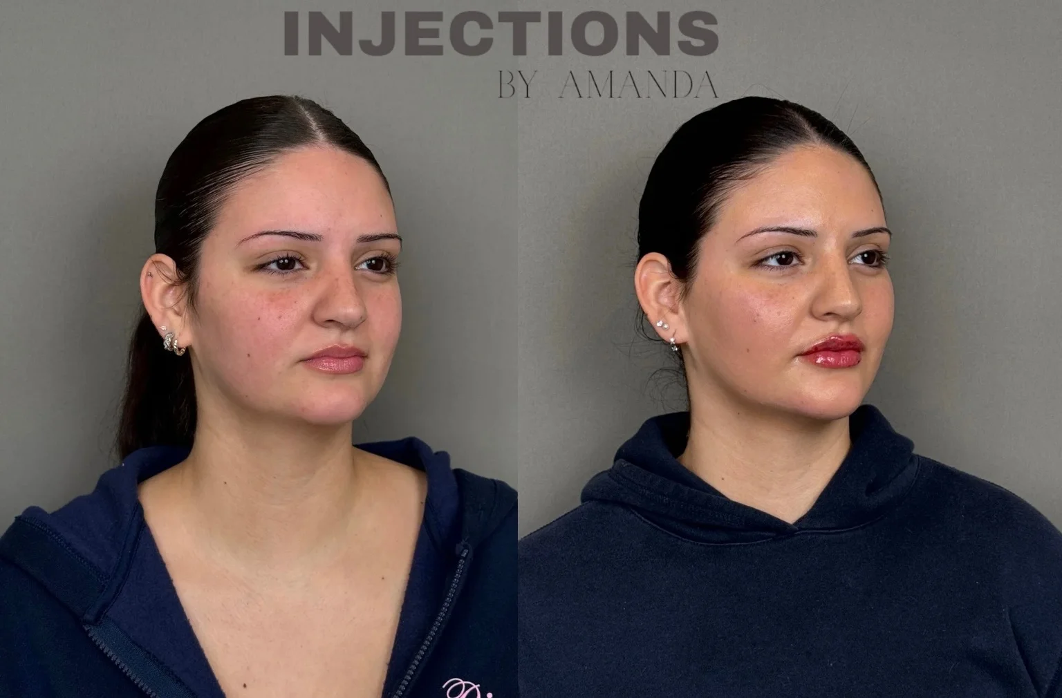 Better Than Ever Package Before and After - 24 better-than-ever-package-before-and-after-5