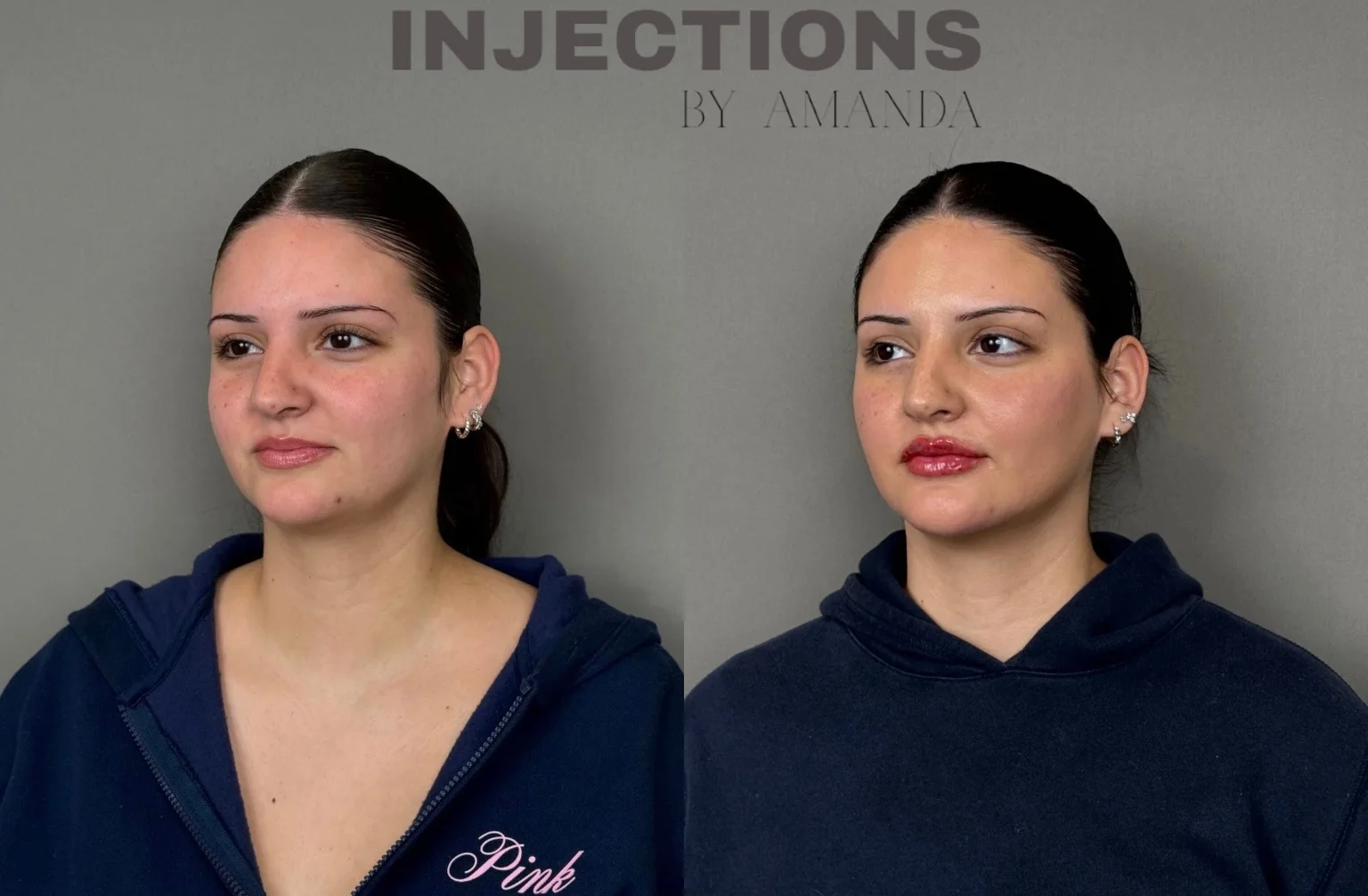 Better Than Ever Package Before and After - 25 better-than-ever-package-before-and-after-6