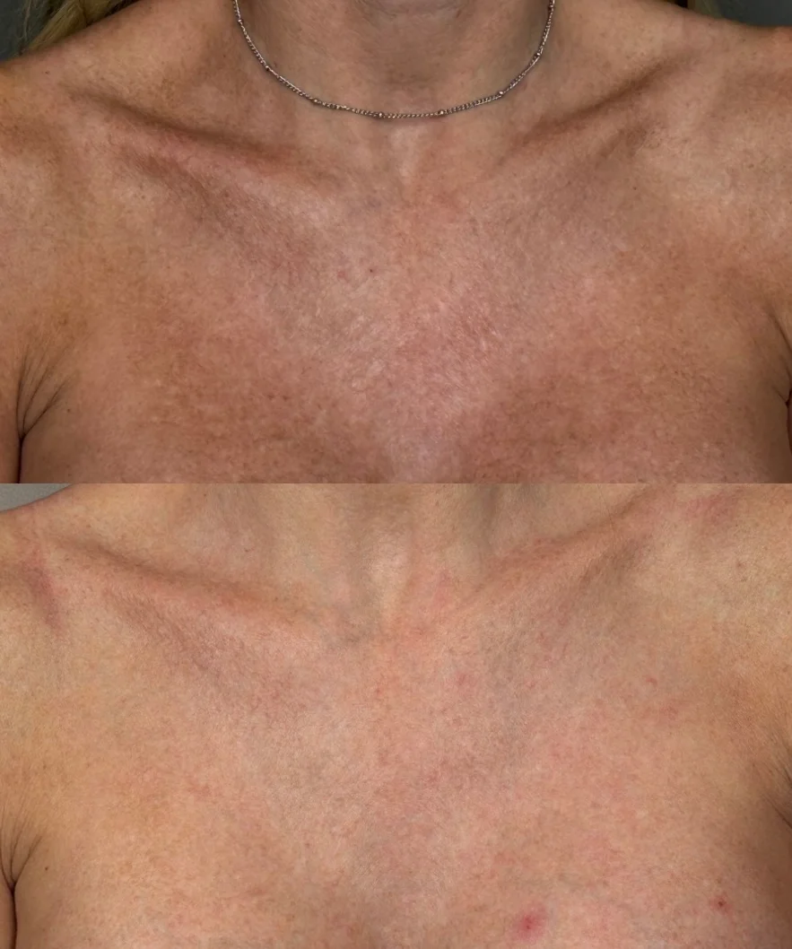 HALO Results: Before & After Image - 7 BBL HALO