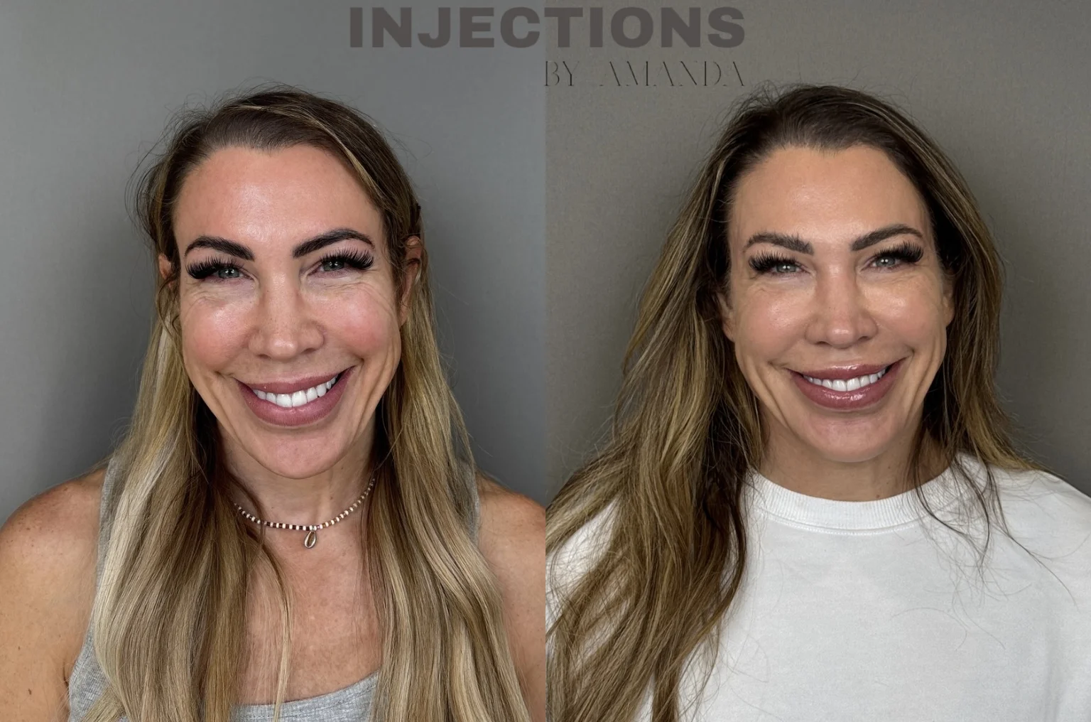 Better Than Ever Package Before and After - 1 Better Than Ever 1