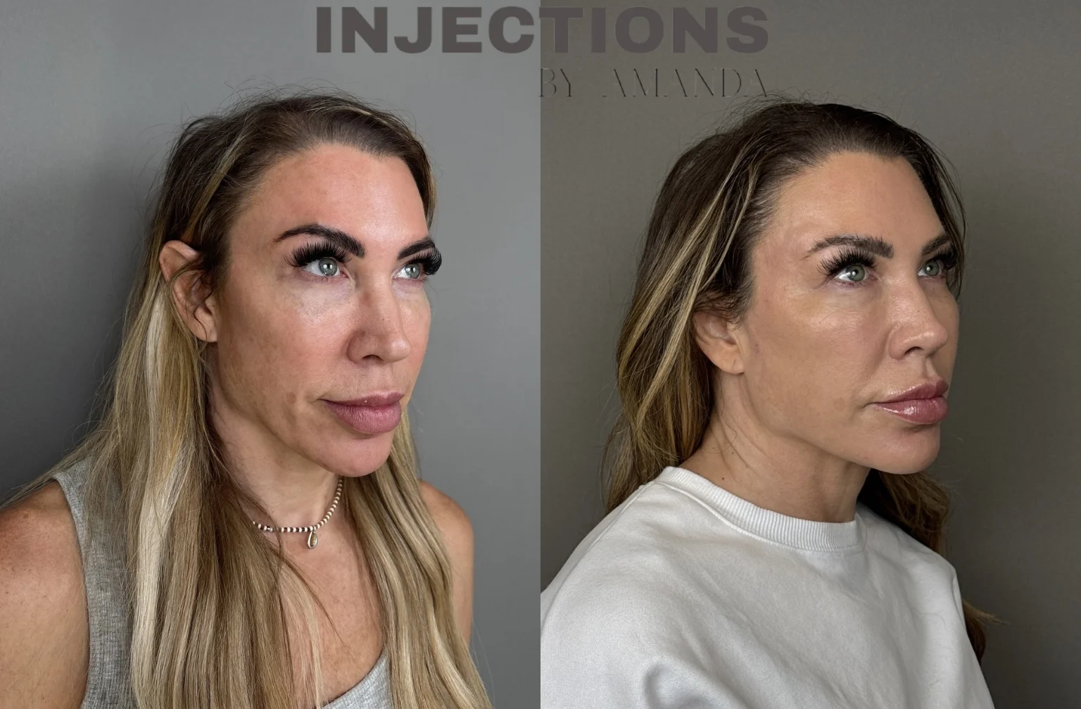 Better Than Ever Package Before and After - 2 Better Than Ever 2