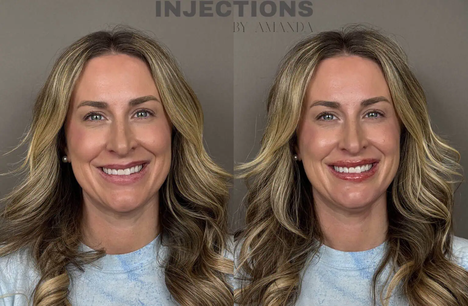 Perfect Profile Package Before and After Images - 3 Perfect Profile 1a
