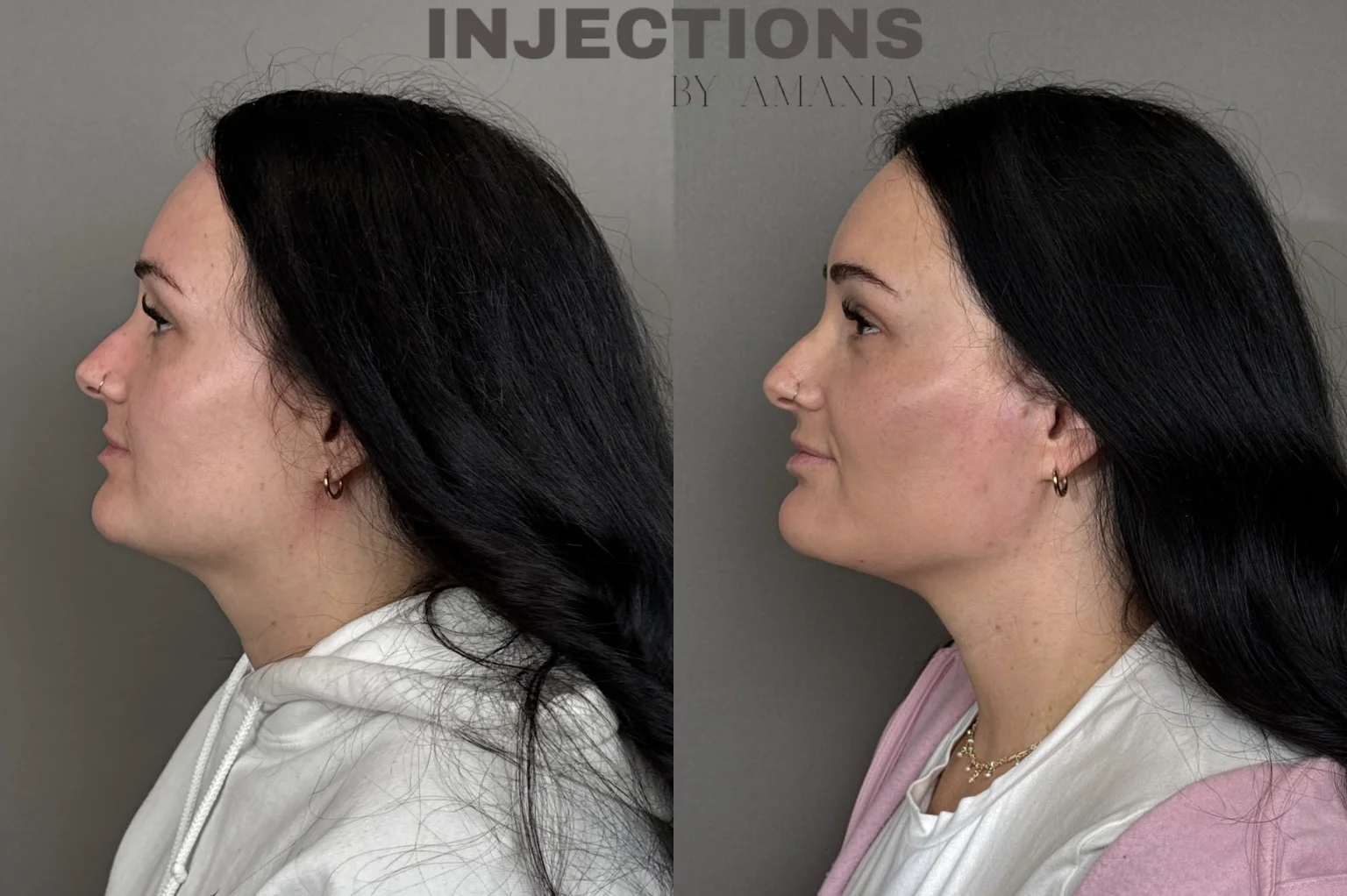 Youthful Essence Before and After Images - 3 Youthful Essence3