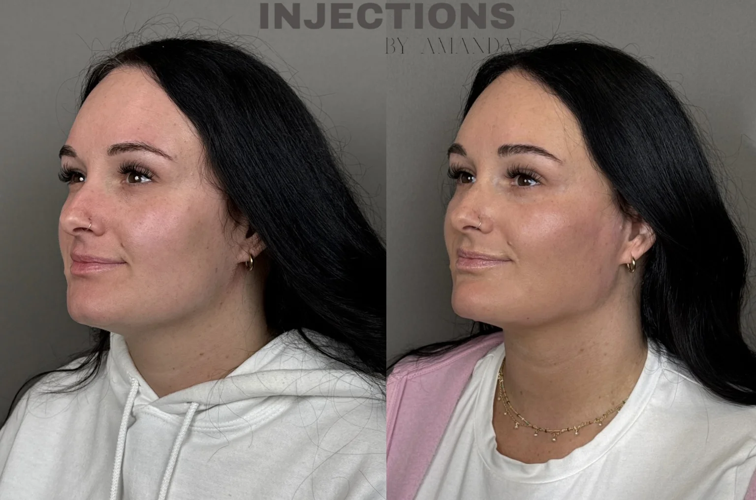 Youthful Essence Before and After Images - 4 Youthful Essence4