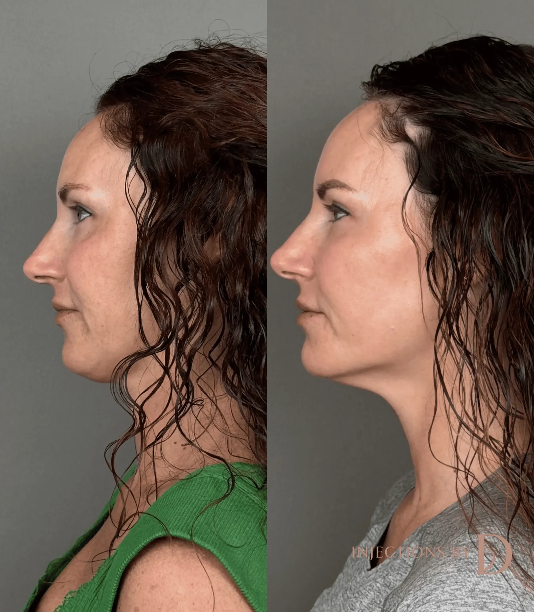 Better Than Ever Package Before and After - 30 Better Than Ever 22