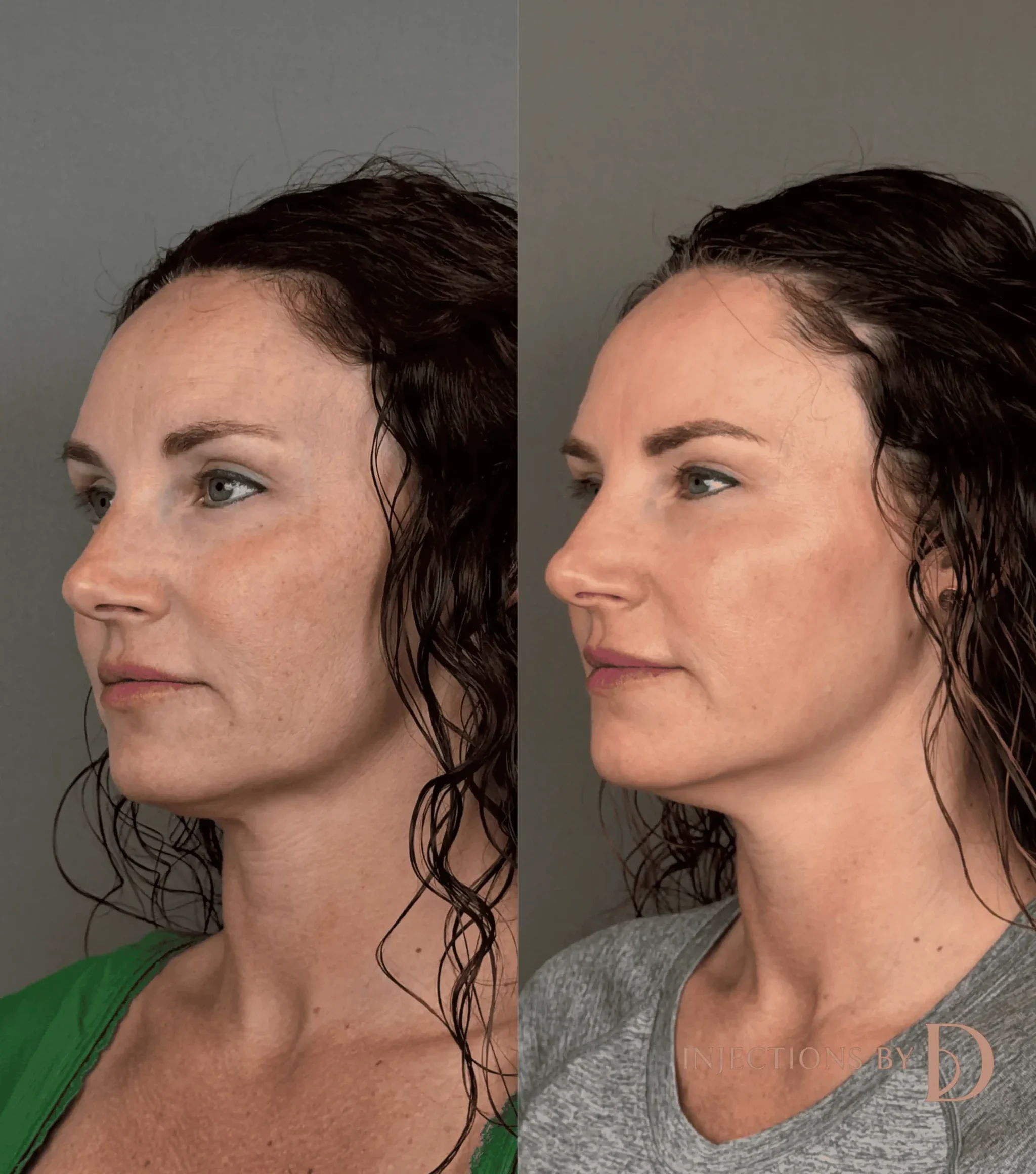 Better Than Ever Package Before and After - 29 Better Than Ever 23
