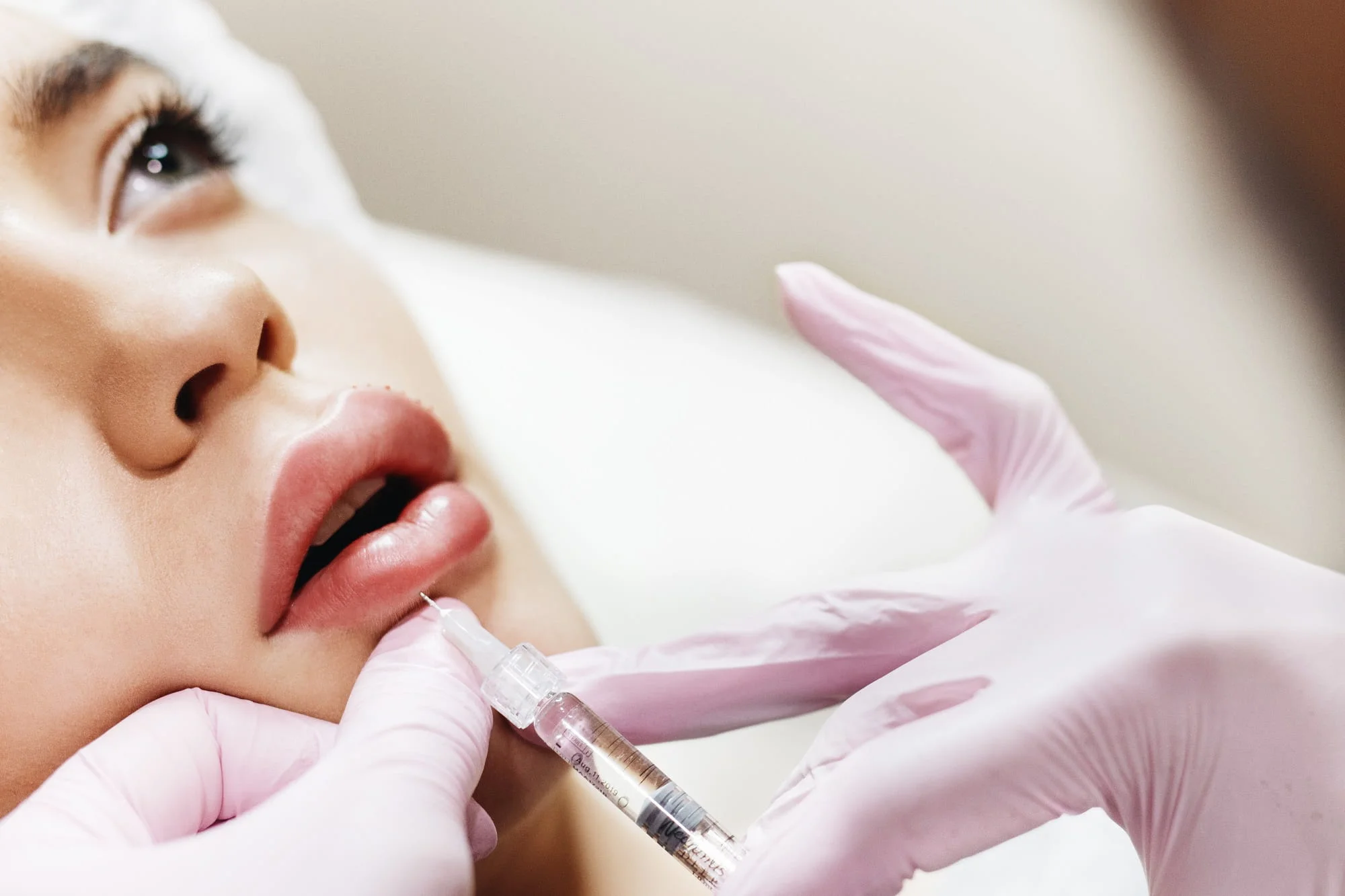 The Ultimate Guide to Lip Filler vs Jawline Filler Benefits and Cost