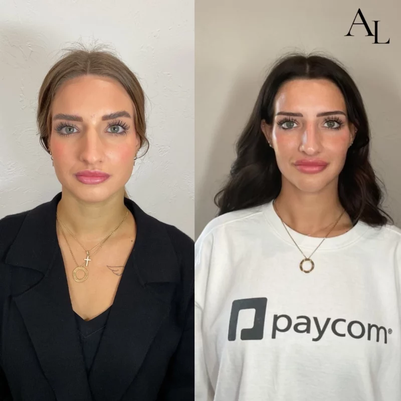 Face-before-after